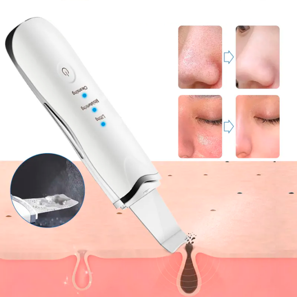 Аппарат для чистки лица Ultrasonic ZTY-0917 Белый  photo 3
